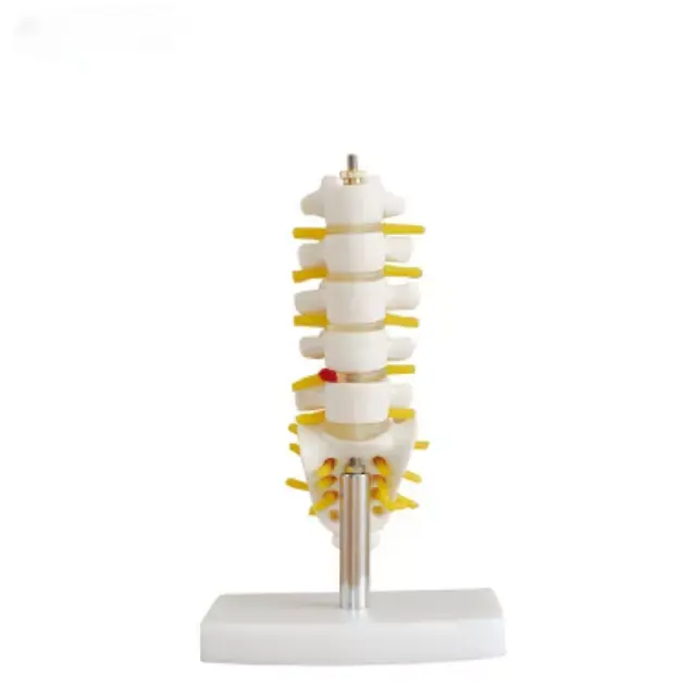 Vertebras lumbares con sacro, coccix y hernia de disco,