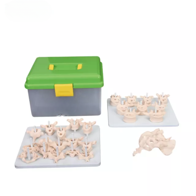 Columna vertebral desarticulada