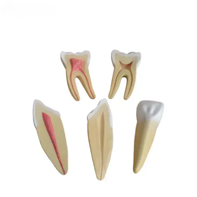 Expansion de los dientes humanos