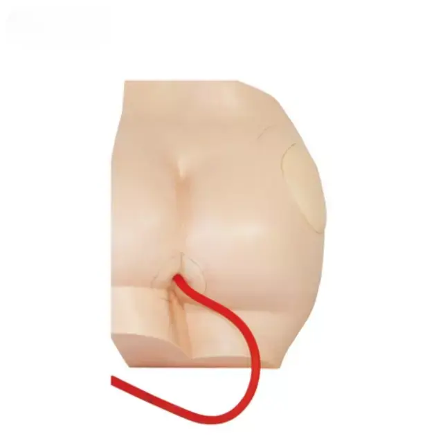 Seiinyeccion de gluteos