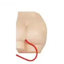 Seiinyeccion de gluteos