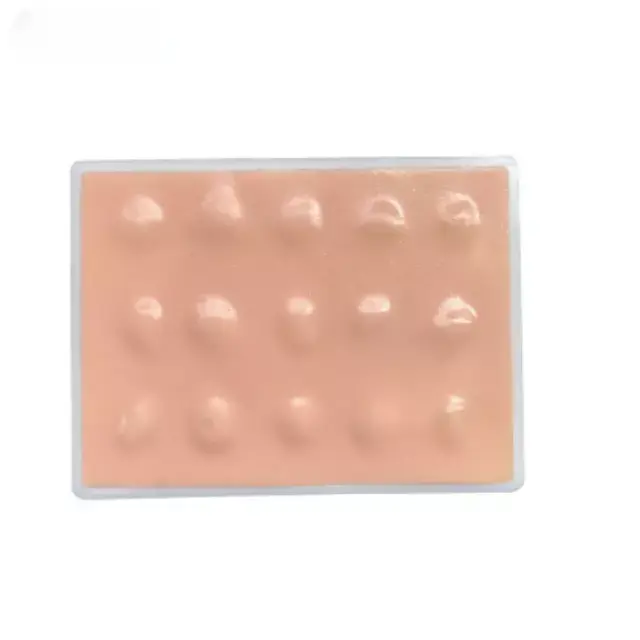 Escision del quiste sebaceo