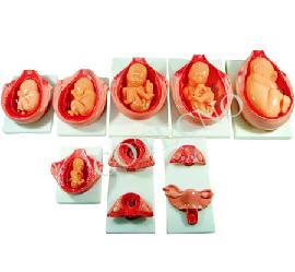 [filler_18551] Modelo de proceso de desarrollo para el feto Bell-PFeT-14 - WP