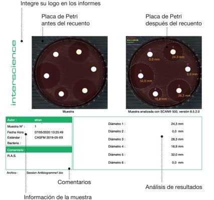 scan rapports compteurs et zi es